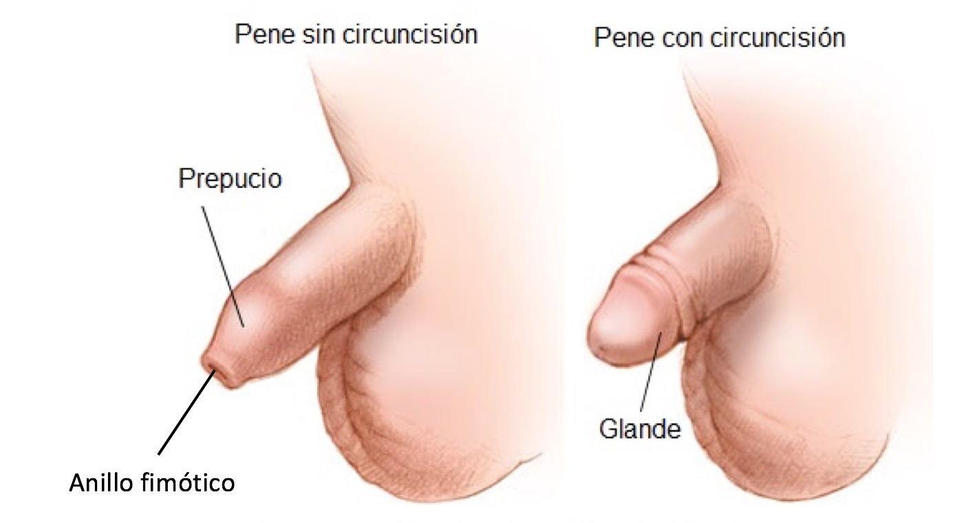 Penes con y sin circuncisión (99) фото