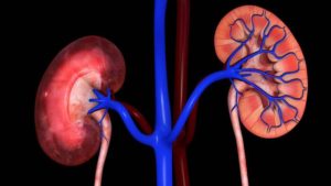Lee más sobre el artículo ¿Cómo afecta el lupus al sistema renal (los riñónes)?